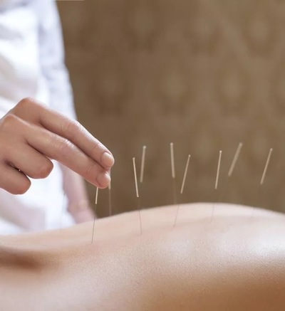Link to: /services/medical-acupuncture-dry-needling